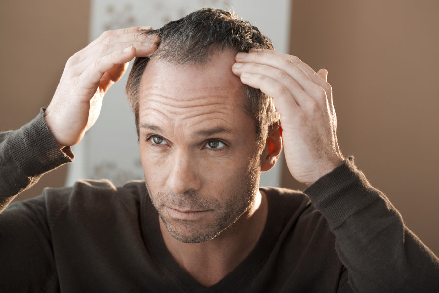 Hair Loss Treatment in Rawalpindi